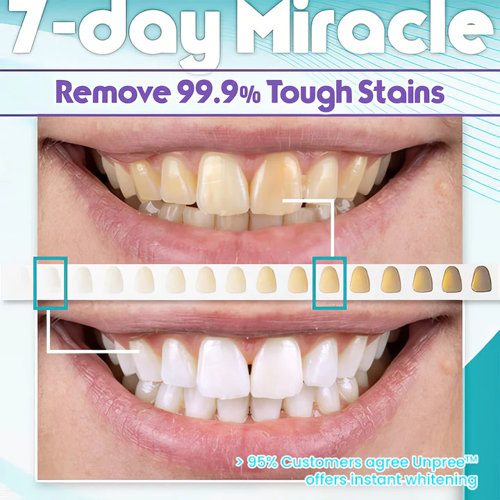 UNPREE™ NEW V34 Toothpaste Purple Color Corrector - Image 9