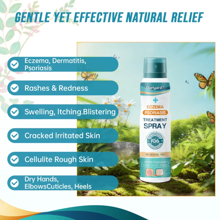 Ourlyard Psoriasis- und Ekzem-Naturheilmittel-Spray