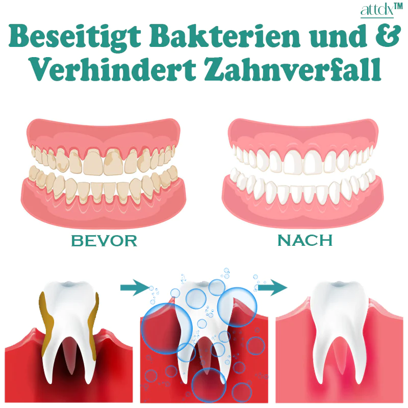ATTDX 360° Frische Nebel Tiefenreinigendes Mundwasser - Image 4