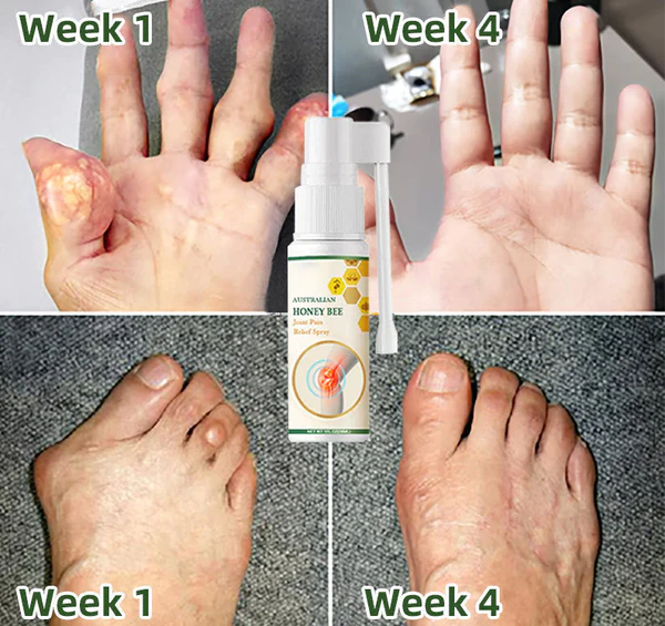 Lotmay Bee Venom Pain and Bone Healing Spray