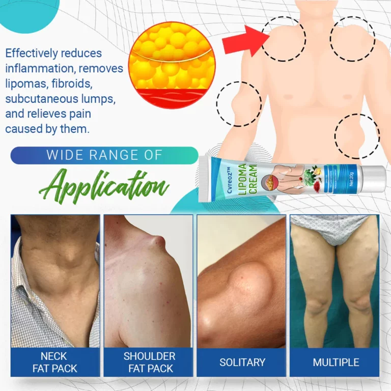 Uachtar toirt air falbh KISSHI ™ Lipoma - Ìomhaigh 4