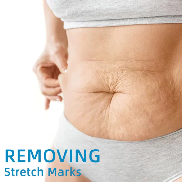 BeYou Beauty Women Collagen Lifting Body Oil - Image 7