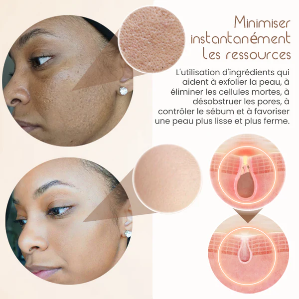 Oveallgo FirmLuxe CrA¨me Magique Multi-Puissance Raffermissante