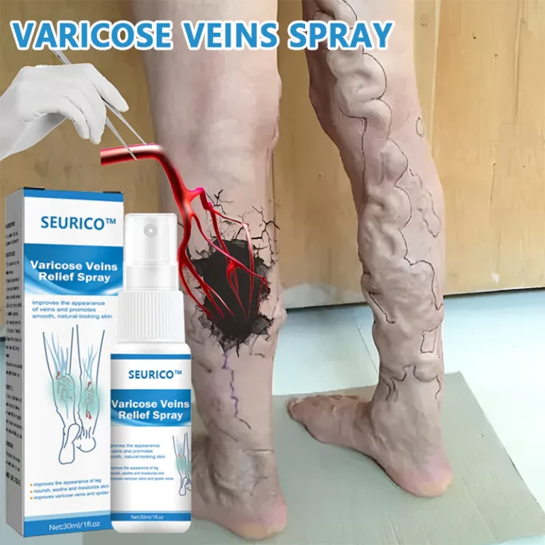 Seurico™ Vein Varicose Relief Spray - Image 10