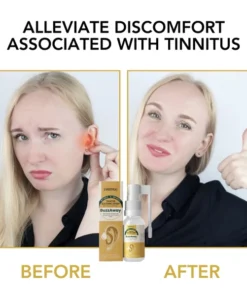 Fivfivgo™ BuzzAway Propolis Tinnitus Beruhigungsspray