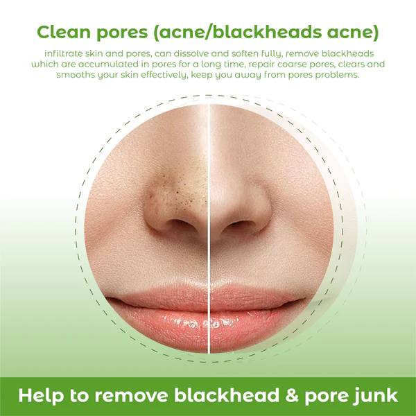 ATTDX Deep PurifyingPore Banishing Kit - Image 10