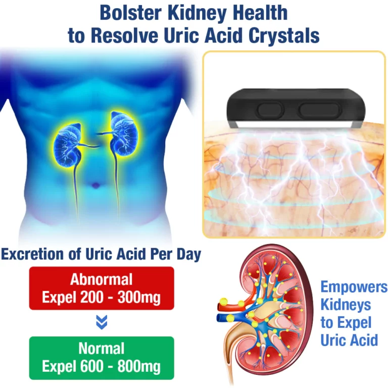 GFOUK™ UricEase Microcurrent Therapy Device - Image 6