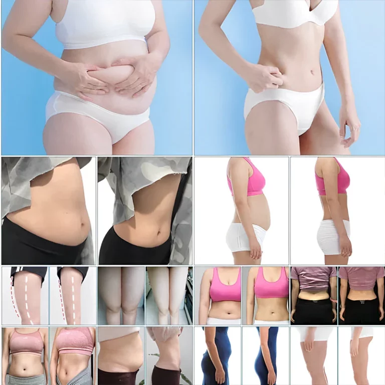 Seurico™ Caffeine Body Firming Cream - Image 8