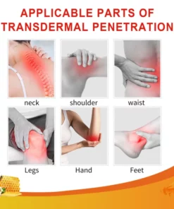 Alternative view of Lotmay™ Bee Venom Joint Therapy Pain Relief Gel