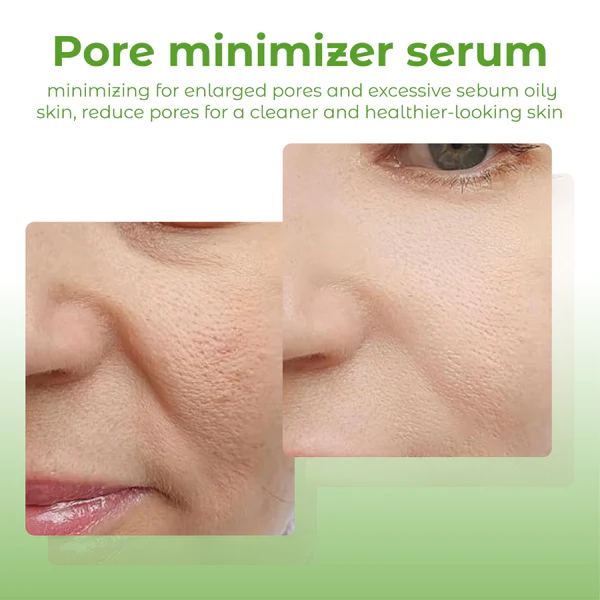 ATTDX Deep PurifyingPore Banishing Kit - Image 9