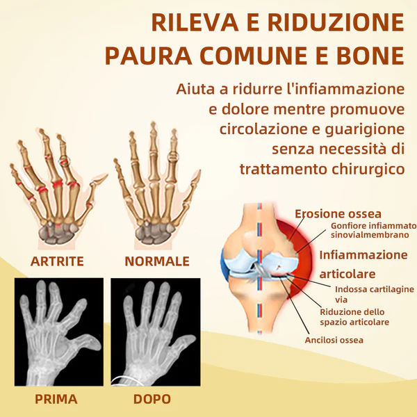 Thonesr Golden Scorpion Pain Relief and Bone Healing Cream