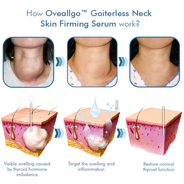 Oveallgo™ Goiterless Neck Skin Firming Serum - Image 6
