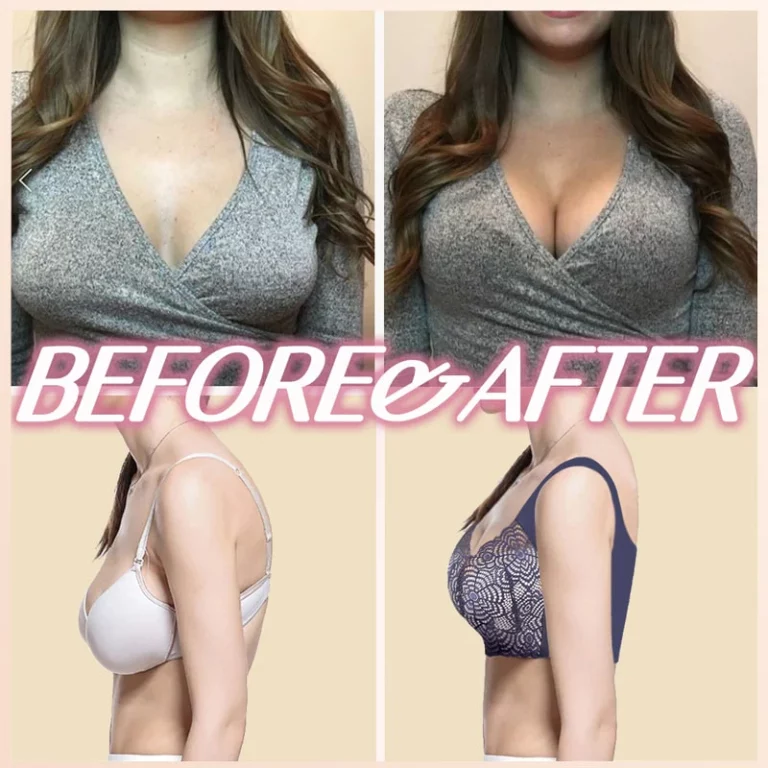 COLORIVER™ Bee Venom Shaping Bra - Image 3