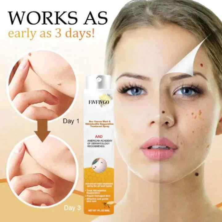 Fivfivgo™ Warze und Tags Entfernungsbehandlungsspray - Image 5