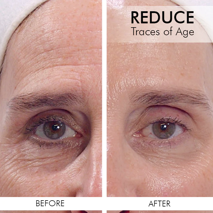 Oveallgo™ Retinol Intense Advanced Triple Action Eye Cream - Image 5