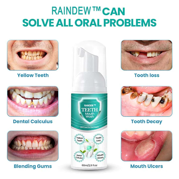 Raindew™ NEW TEETH Mouthwash – Solve all Oral Problems - Image 3