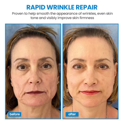 KISSHI™ Botox Facial Essence - Image 5