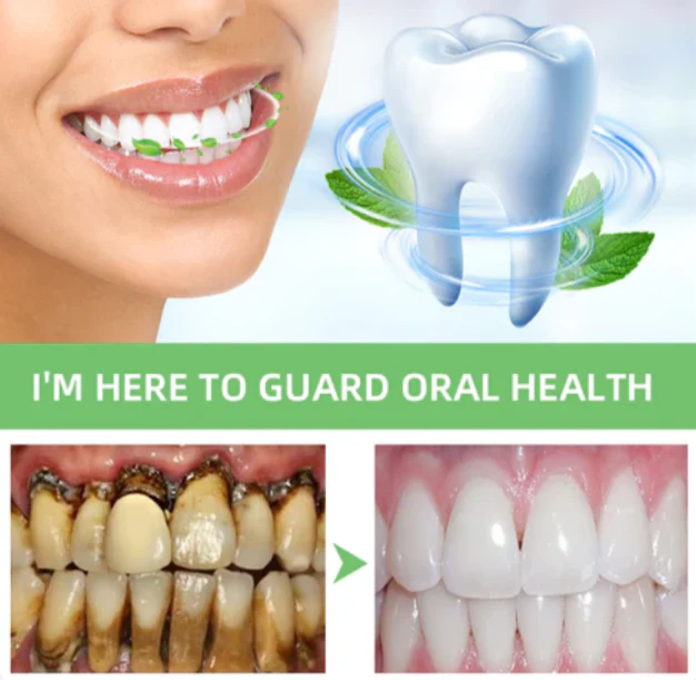 SEAGRIL™ Herbal Brightening Oral Repair Mousse - Image 6