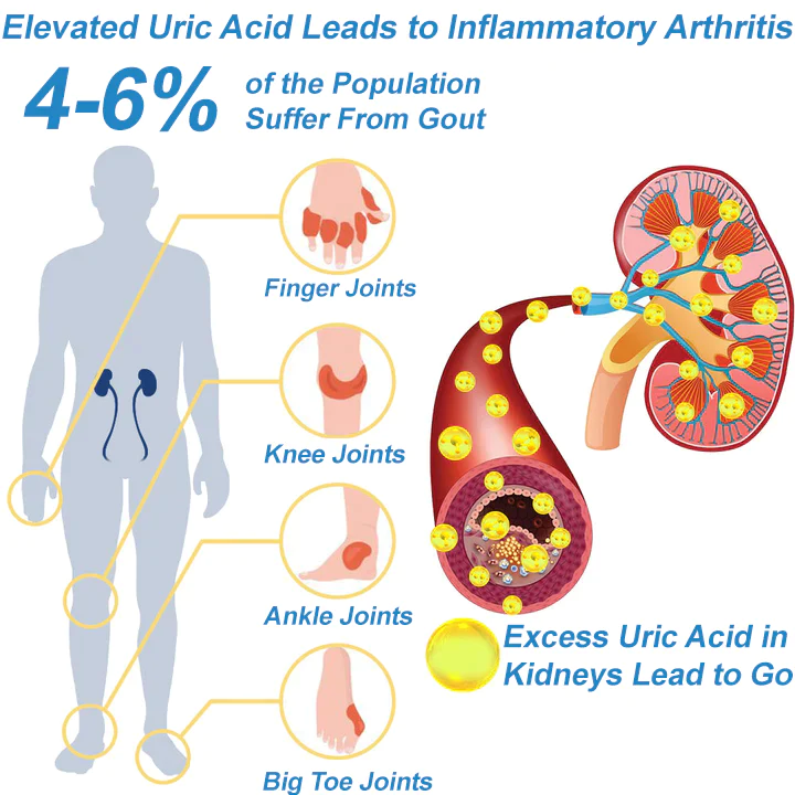 NORUION® Microcurrent EMS Therapy Bracelet - Image 7