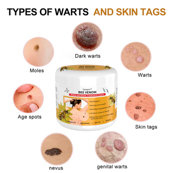 Lenaro™ Bee Venom Mole and Wart Treatment Cream - Image 10