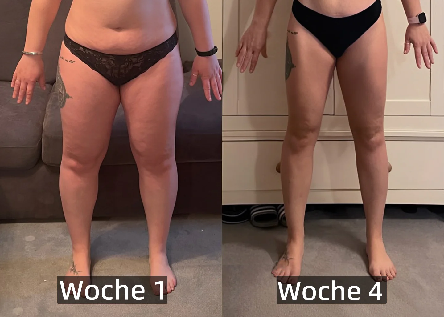 Lotmay™ Bienengift Lymphdrainage Schlankheitspflaster - Image 8