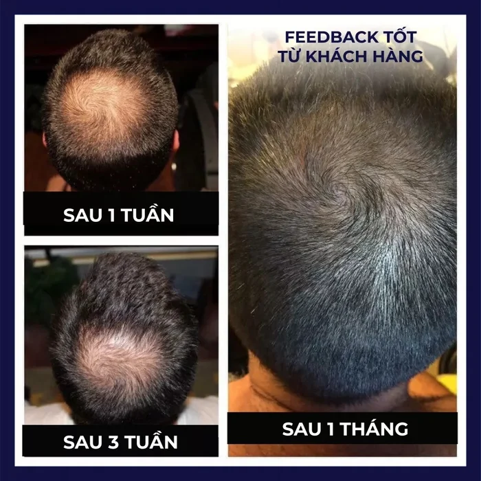 Spray Kwasans CheveRegrowth - Imaj 7