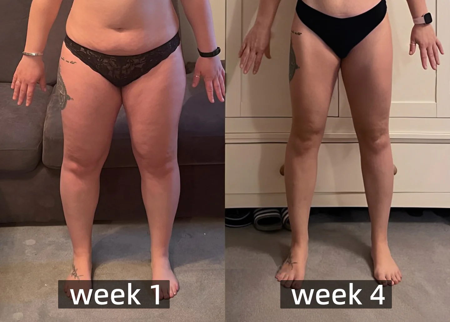 Furzero™ Bee Venom Detox Slimming Patch - Image 21