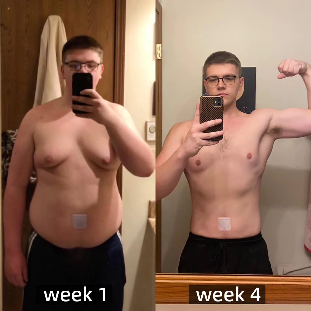 Edijonah™ Bee Venom Lymphatic Drainage Slimming Patch - Image 6