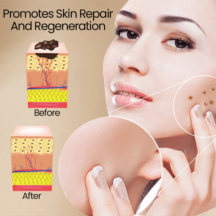 Ceoerty™ Bee Venom ClearSkin Wart and Tags Removal Treatment Spray - Image 4