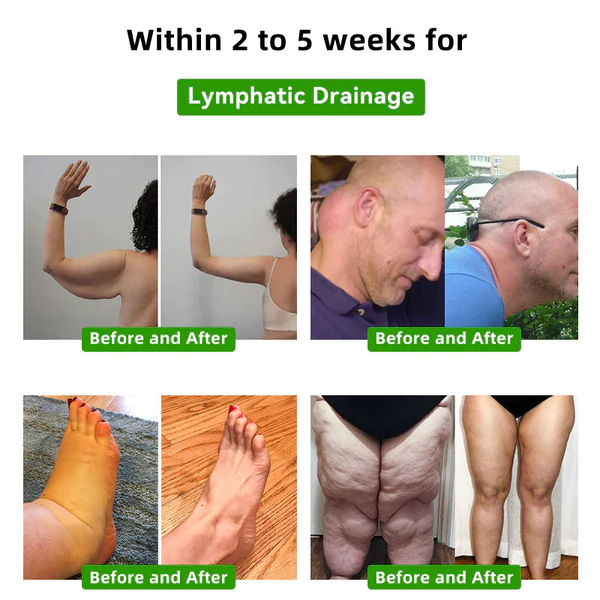 Lotmayโข ๐๐ฒ๐ฒ ๐ฉ๐ฒ๐ป๐ผ๐บ ๐๐๐บ๐ฝ๐ต๐ฎ๐๐ถ๐ฐ ๐๐ฟ๐ฎ๐ถ๐ป๐ฎ๐ด๐ฒ ๐ฆ๐น๐ถ๐บ๐บ๐ถ๐ป๐ด ๐๐ผ๐ผ๐ ๐ฃ๐ฎ๐๐ฐ๐ต - Image 9