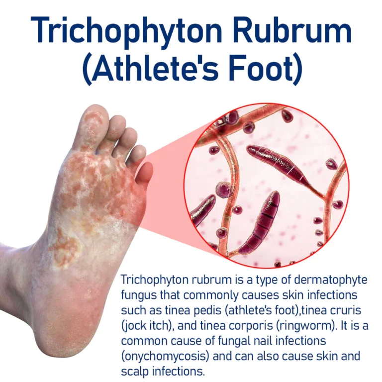 HerbalCare Medical Nail Fungus Foot Spray - Image 4