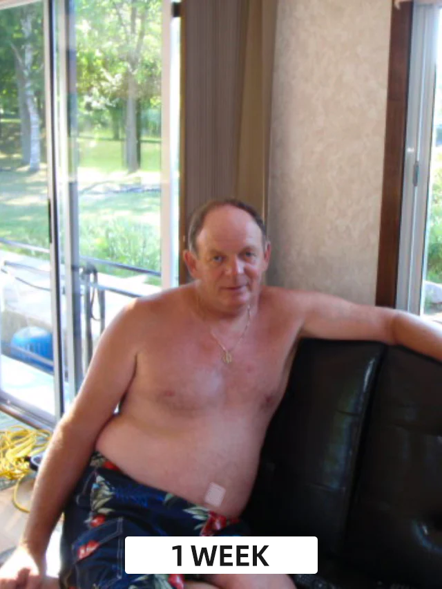 Furzero™ Bee Venom Detox Slimming Patch - Image 18