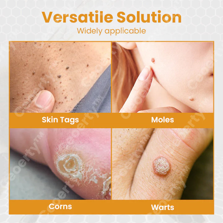 LIMETOW™ TagX Bee Venom Treatment Spray - Image 9