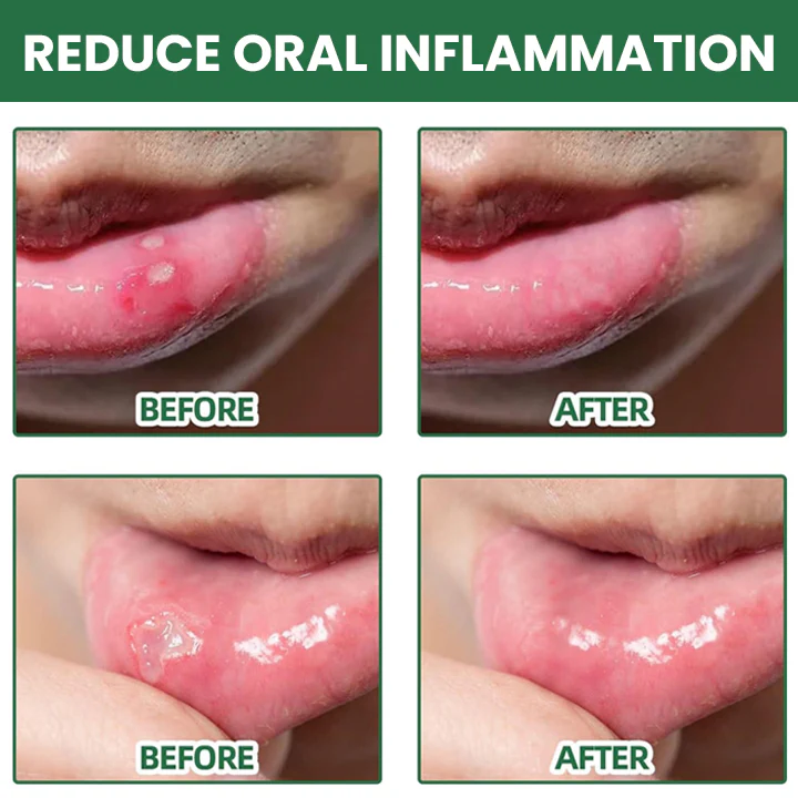 LIMETOW™ Ultra Healing Herbal Mouth Spray - Image 7