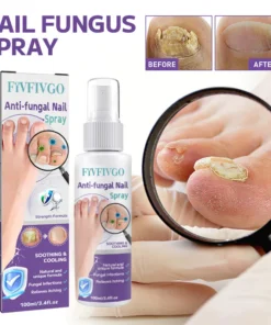 Fivfivgo™ Anti-Pilz-Nagelspray