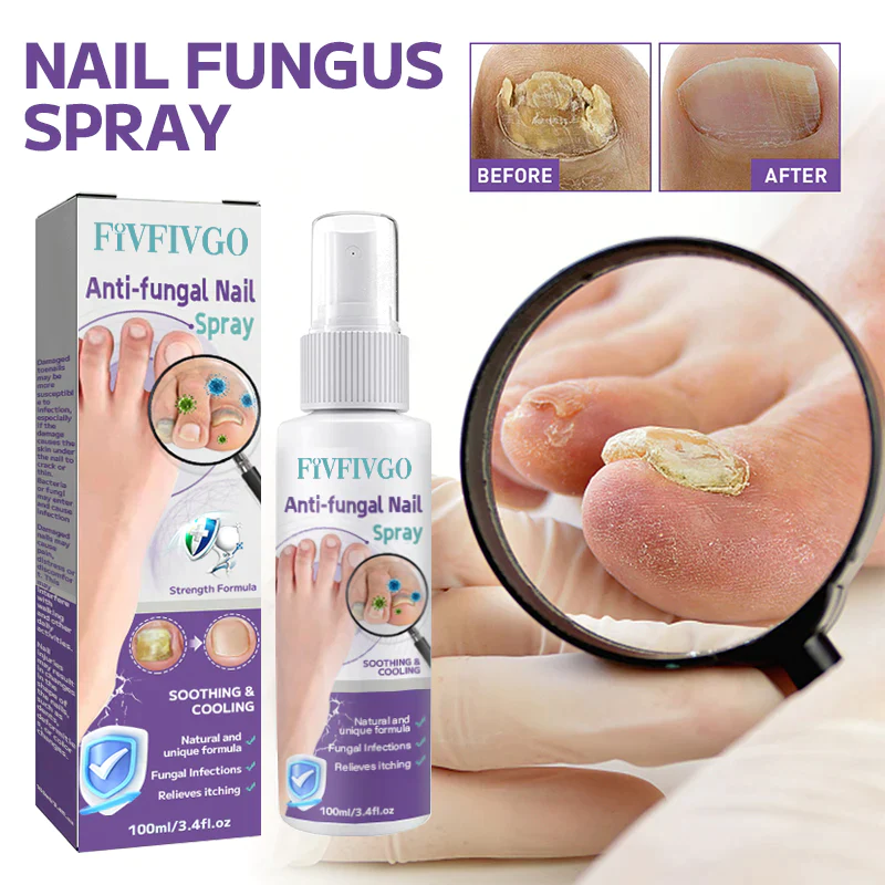 Fivfivgo™ Anti-Pilz-Nagelspray