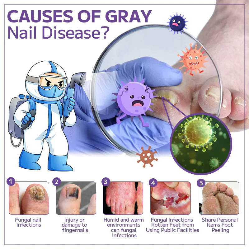 Fivfivgo™ Anti-Pilz-Nagelspray - Image 6