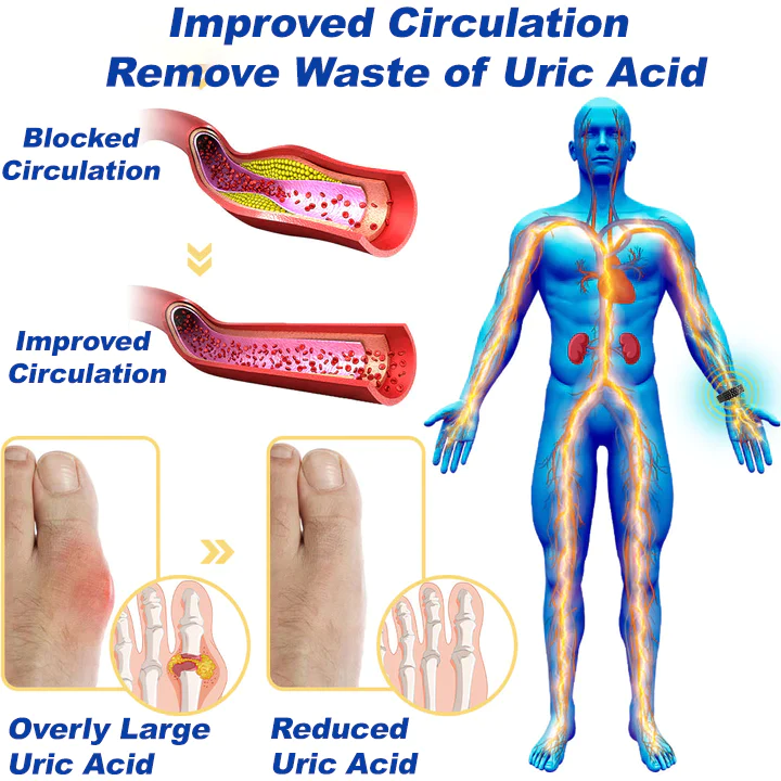 NORUION® Microcurrent EMS Therapy Bracelet - Image 4