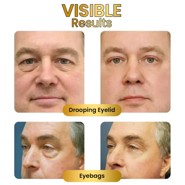 EyeRevive™ Firming Eye Cream - Image 9