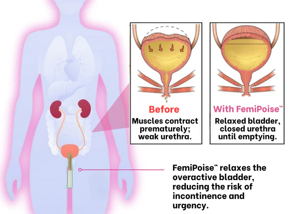 FemiPoise™ Bladder Control Gel - Image 5