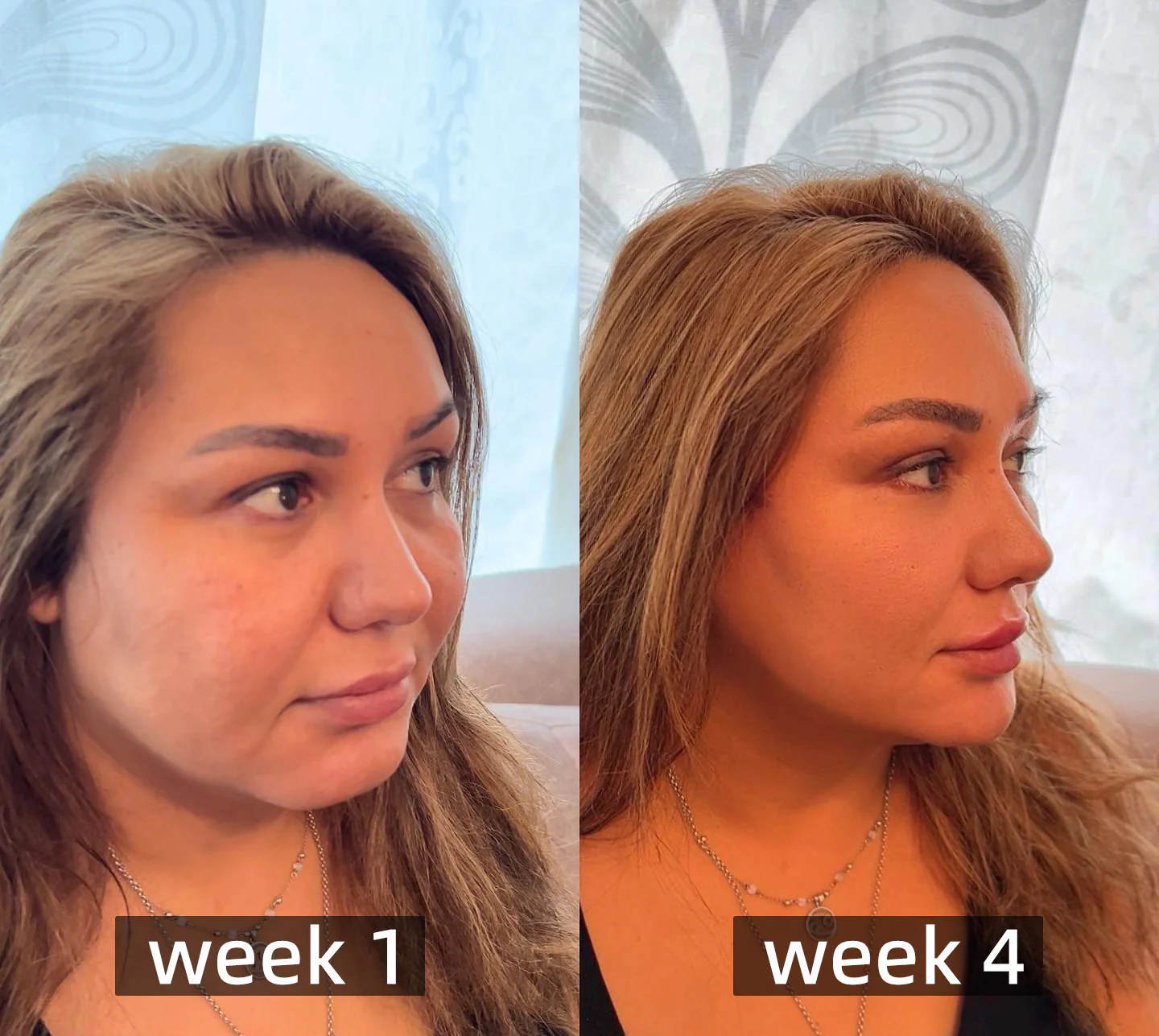 Furzero™ Bee Venom Detox Slimming Patch - Image 9