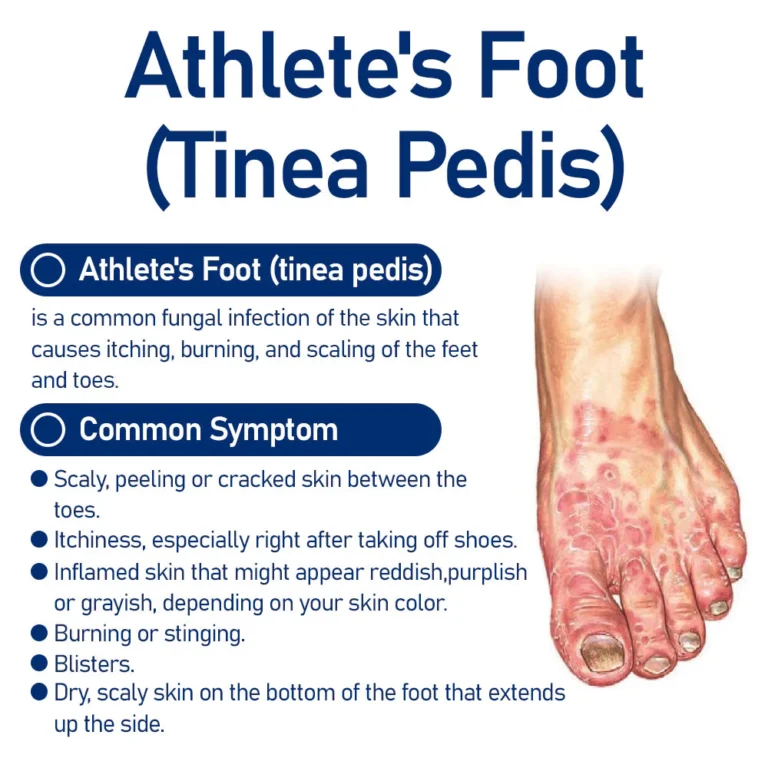 HerbalCare Medical Nail Fungus Foot Spray - Image 3