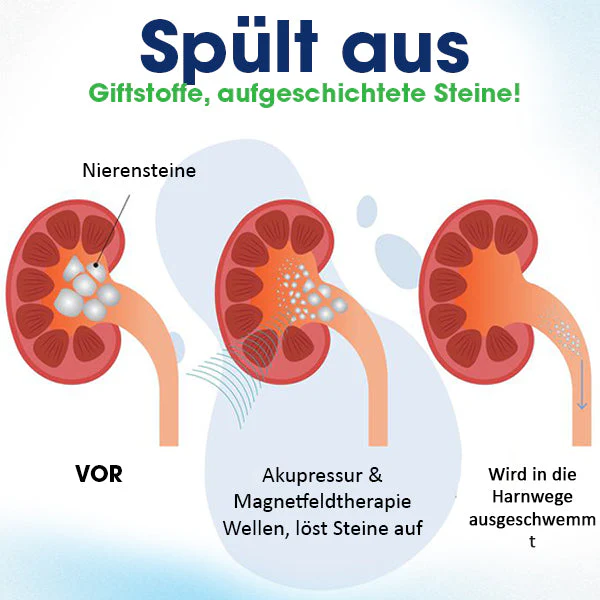 AEXZR™ Akupressur Nierenpflege-Gürtel - Image 6