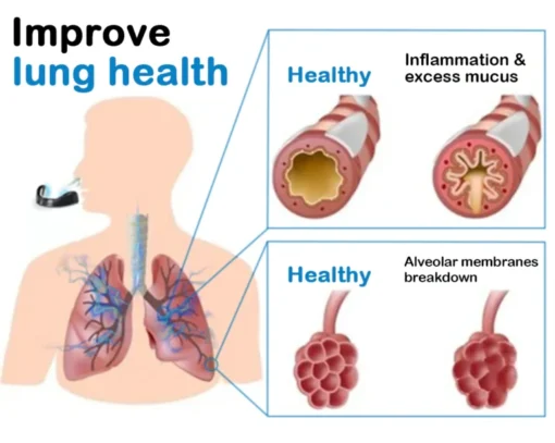 DOCTIA™ Magnetic Deep Lung Cleansing Nasal Dilator - Image 7