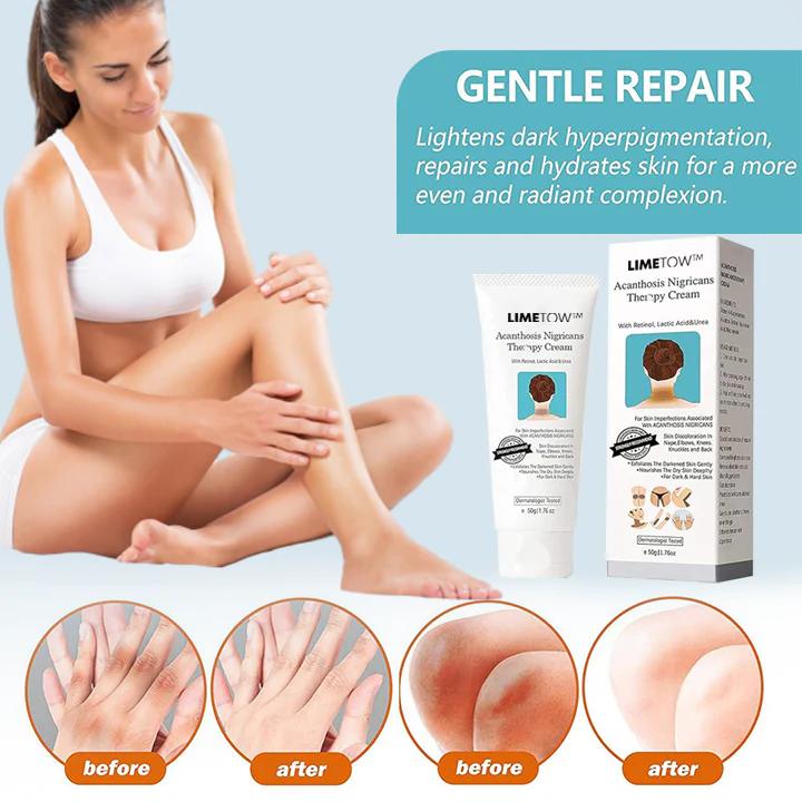 LIMETOW™ Acanthosis Nigricans Therapy Cream - Image 3