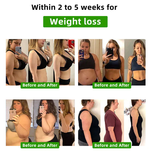 Lotmayโข ๐๐ฒ๐ฒ ๐ฉ๐ฒ๐ป๐ผ๐บ ๐๐๐บ๐ฝ๐ต๐ฎ๐๐ถ๐ฐ ๐๐ฟ๐ฎ๐ถ๐ป๐ฎ๐ด๐ฒ ๐ฆ๐น๐ถ๐บ๐บ๐ถ๐ป๐ด ๐๐ผ๐ผ๐ ๐ฃ๐ฎ๐๐ฐ๐ต - Image 7