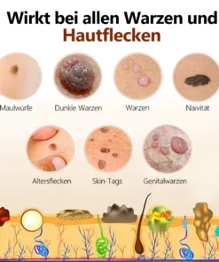 Alternative view of Lenaro™ Bienengift Maulwurf und Warze Behandlung Creme