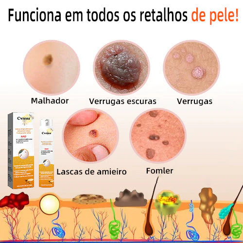 Fesa cirewa de verrugas e etiquetas Cvreoz com veneno de abelha - Hoto 4