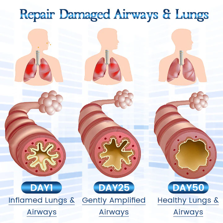 Biancat™ ReviveUltra Kräuter-Lungenreinigungsspray - Image 7