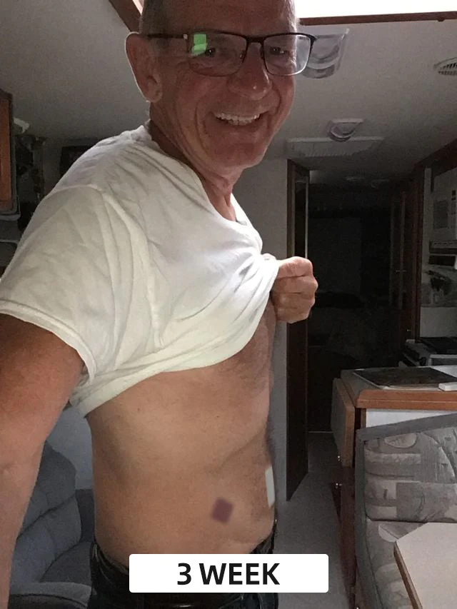 Furzero™ Bee Venom Detox Slimming Patch - Image 8